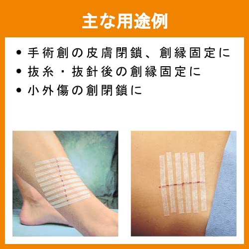 Reinforced Skin Closure Strips - 1/4" x 4" - 10 Count