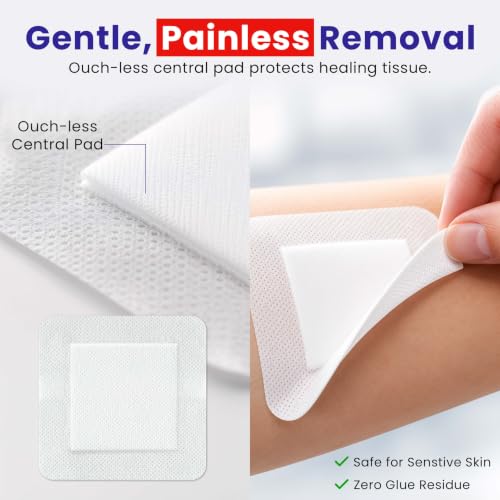 Sterile Bordered Gauze Island Dressings - 4"x4", 30 Count