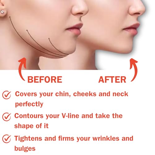 AURAFIX Medium Beige Post-Surgical Chin Strap - Neck & Chin Compression Bandage for Recovery