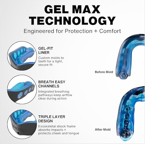 Shock Doctor White Adult Gel Max Mouth Guard – Custom Fit, Heavy Duty Protection