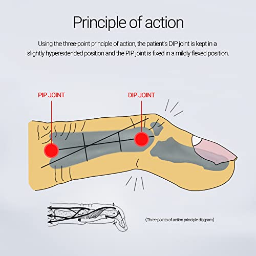 Finger Splint Brace - 2 Pieces Adjustable Support for Knuckle Protection