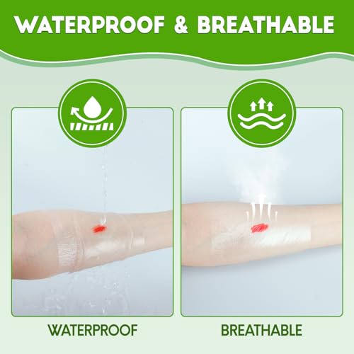 50 Pack Waterproof Transparent Film Dressings - Large 4x4.75 inch, Wound & Post-Surgical Care