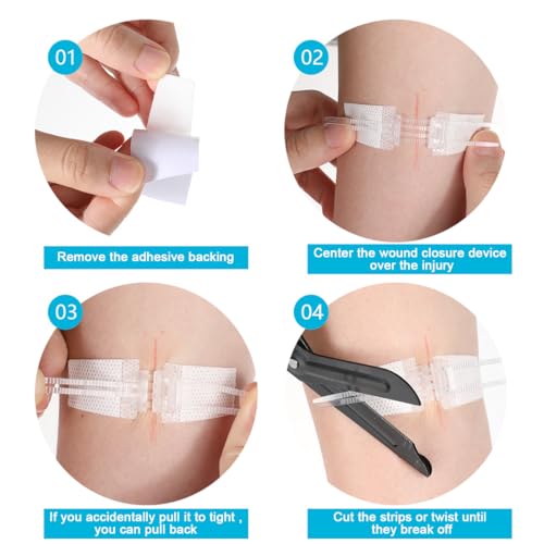 Sterile Wound Closure Strips - 5PCS First Aid Adhesive Bandages