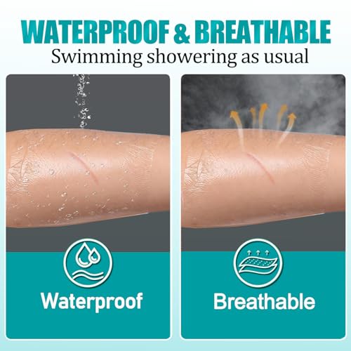 Waterproof Transparent Film Dressing - 100 Pack, 2.37" x 2.75"