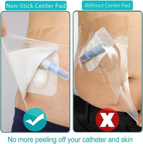 10"x12" Waterproof Shower Cover Incision Bandages for Large Wound with No Glue On The Center Adhesive Transparent Shower Protector Post Surgical Water Barrier Guard Pack of 7