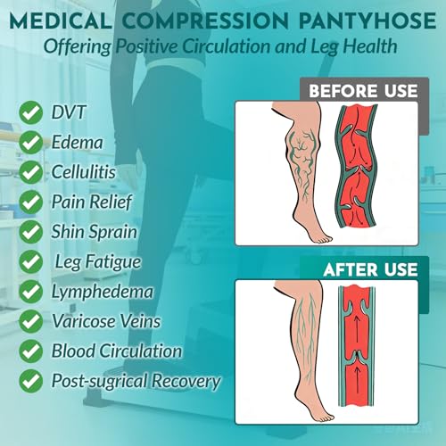 Koeosso X-Large Compression Leggings Medical Pantyhose Stockings for Women – Black