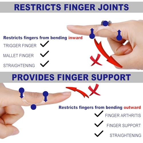 Clear Finger Splint & Sleeve Kit - 10 Pcs, Sizes 4-9