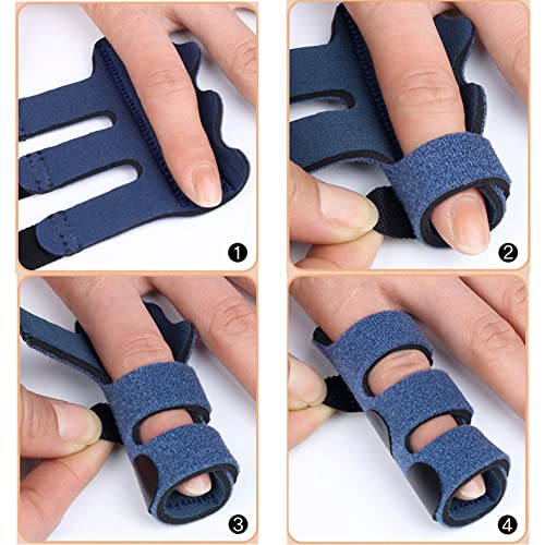 Finger Splints for Pain Relief - Adjustable 4-Pack with Straps - Multi