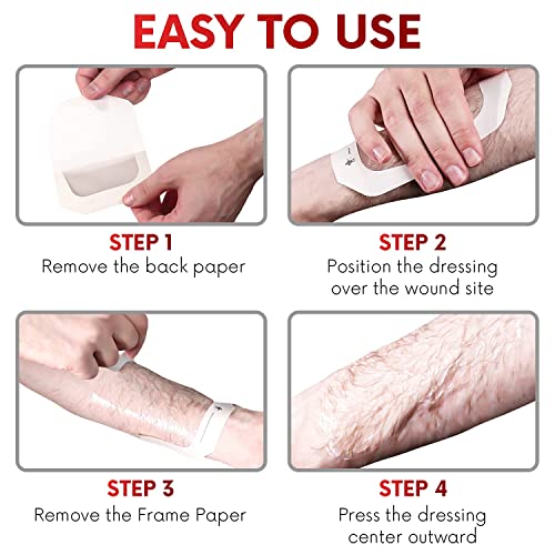 Transparent Film Dressing 4" x 4.7" (10 Pack) - Waterproof Adhesive Bandages