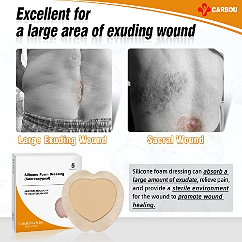 Carbou 9x9 Inch Silicone Sacrum Foam Dressing Pack of 5 for Wound Care
