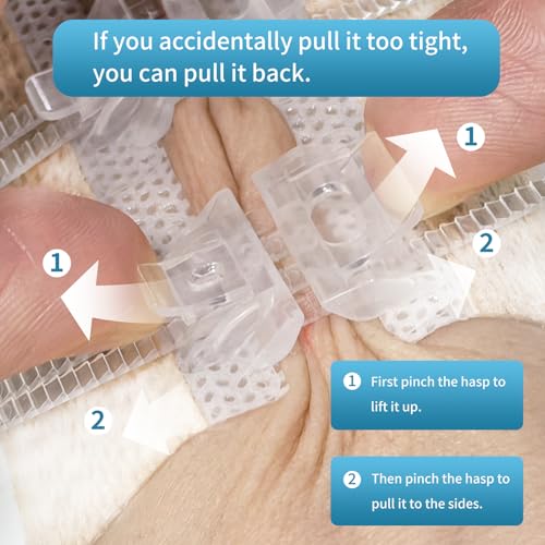 Zip Stitch Wound Closure Strips - 1.5x8cm Emergency Kit