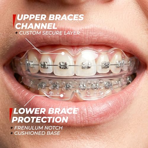 Kids Mouth Guard for Braces - No-Boil, Dual-Arch Protection