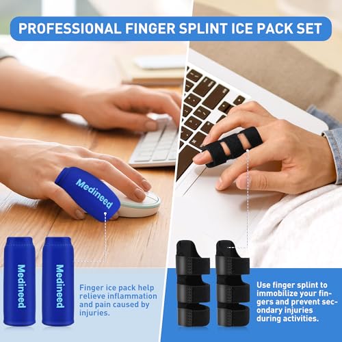 Finger Ice Pack & Trigger Finger Splint Set - Blue & Black