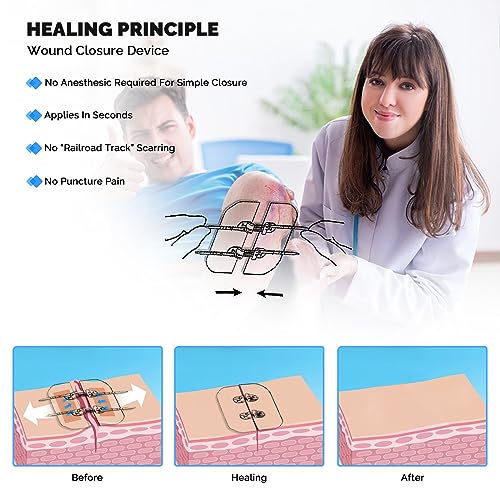 Emergency Wound Closure Strips - 2 Pcs Zip Stitch Kit