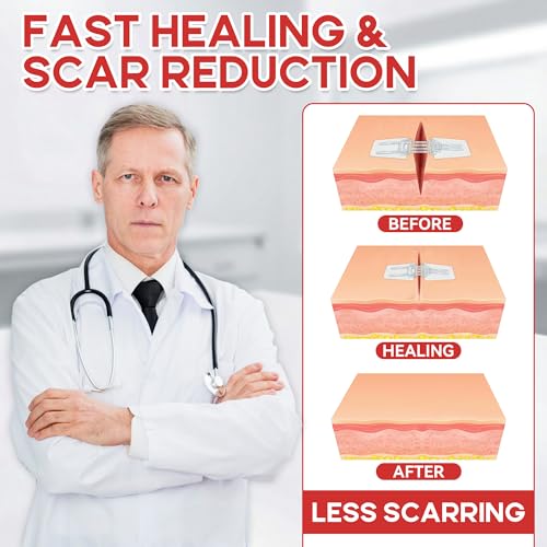 3 Pack Adjustable Needle-Free Wound Closure Strips for Minor Cuts