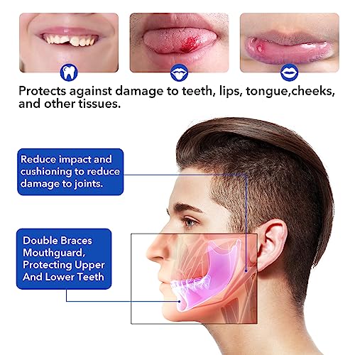 Mouth Guard for Sports - Soft, No Boiling, Blue/Strapless