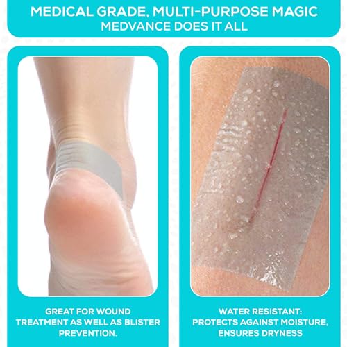 MedVance Silicone Adhesive Medical Tape, Scar Sheet, 2" x1.5' (1 Pack)