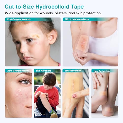 LinToButy Hydrocolloid Wound & Acne Patch Tape Roll 2in x 16ft, Flexible, Waterproof, Cut-to-Size