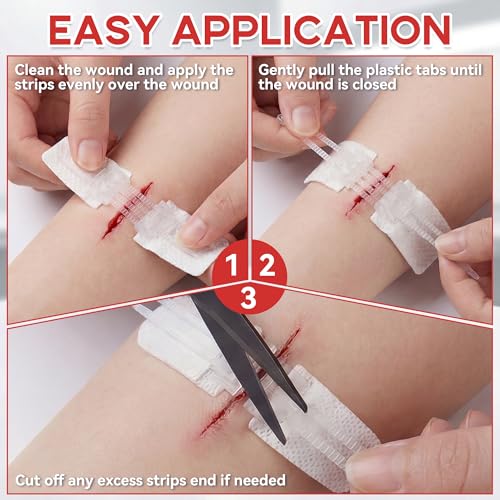 3 Pack Adjustable Needle-Free Wound Closure Strips for Minor Cuts