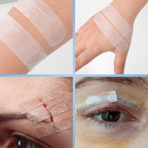 Sterile Wound Closure Strips - 44 Adhesive Skin Closures, 0.8in x 4in