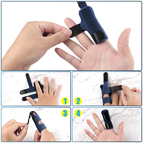 Finger Splint Brace for Trigger Finger & Pain Relief - 2 Pack