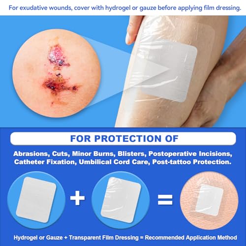 Transparent Film Dressing 4" x 4.75" - 20 Pack Waterproof Wound Cover