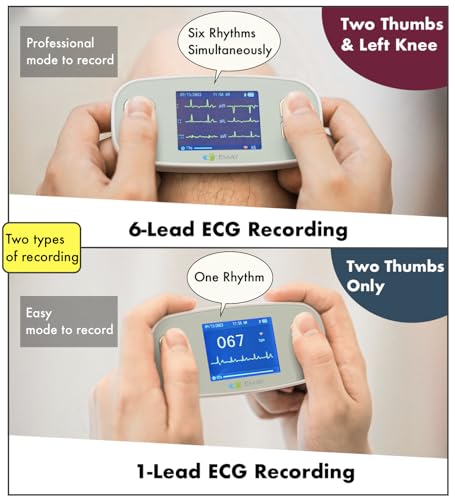 6L Portable ECG Monitor - Record Heart Rate & ECG Signals
