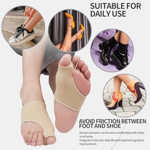 Bunion Corrector and Toe Straightener Splint - 2 Pack - Beige
