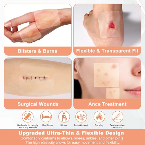 Hydrocolloid Wound Dressing 2" x 2" - 10 Pack Ultra Thin Adhesive Bandages