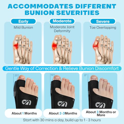 Adjustable Bunion Corrector Toe Straightener Pain Relief Foot Support