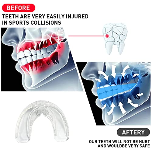 Kids Youth Mouth Guard - Transparent EVA Sports Mouthpiece