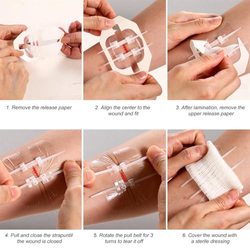 Emergency Wound Closure Strips - 2PCS Zip Stitch Kit, 6x7cm