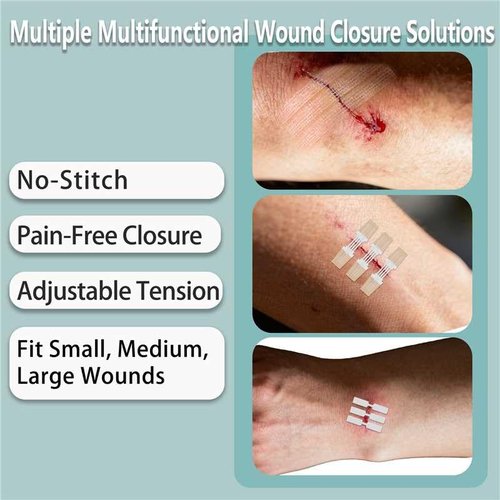 Emergency Wound Closure Strips 29 Pack, 4 Types Zip Stitch Butterfly Bandaids Without Suture, Stitchless & Painless Laceration Closure Kit Butterfly Bandages