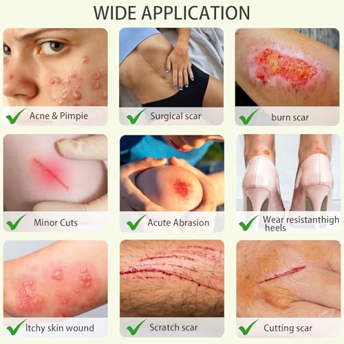 Hydrocolloid Bandage Roll - 2" x 12ft for Acne & Wound Care