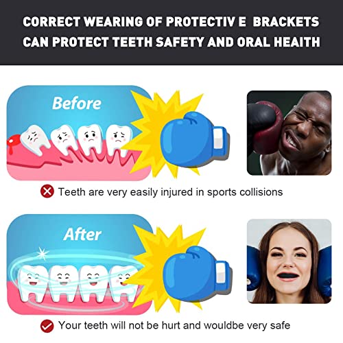 Kids Mouth Guard Sports Braces - 3 Pack Red, Black, White, Blue