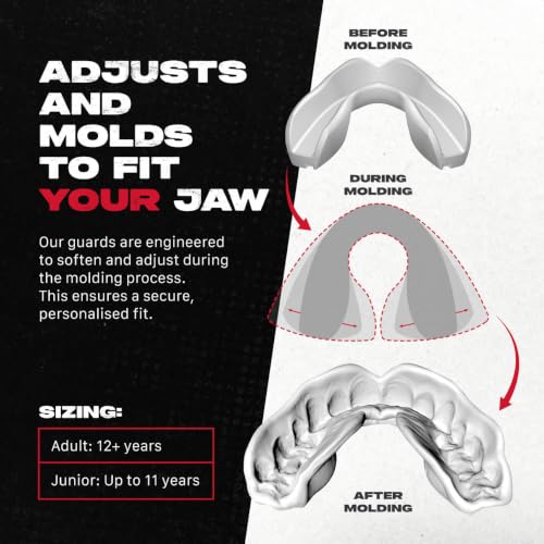 Youth Dual Layer Mouth Guard for Sports - Black Remoldable Shield