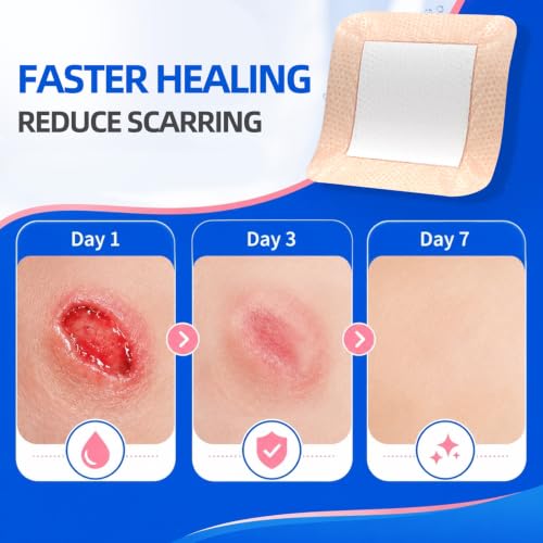 Silicone Foam Lite Dressing for Sensitive Skin 3"x3" (8 Count)–