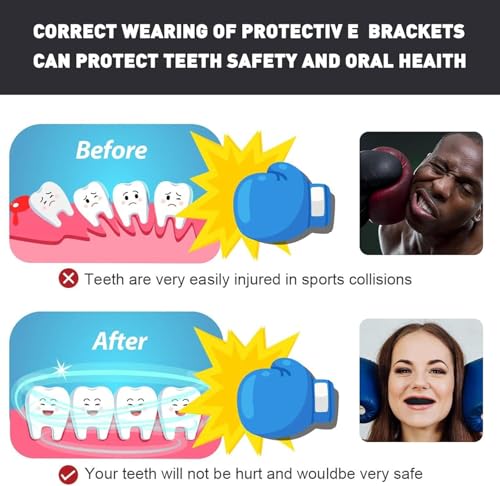Kids Mouth Guard for Sports - Black, Comfortable & Lightweight Protection