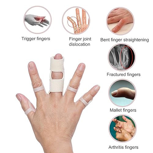 Comfortable Finger Splint Set - 8 Oval & 2 Trigger Splints (Sizes 4-11)