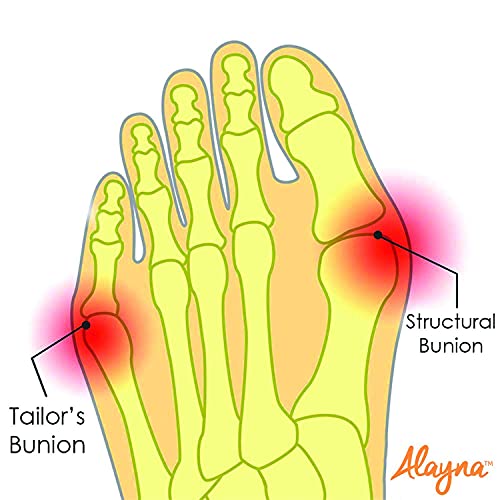 Alayna Bunion Sleeve S Nude — Gel Cushion Foot Support for Women & Men