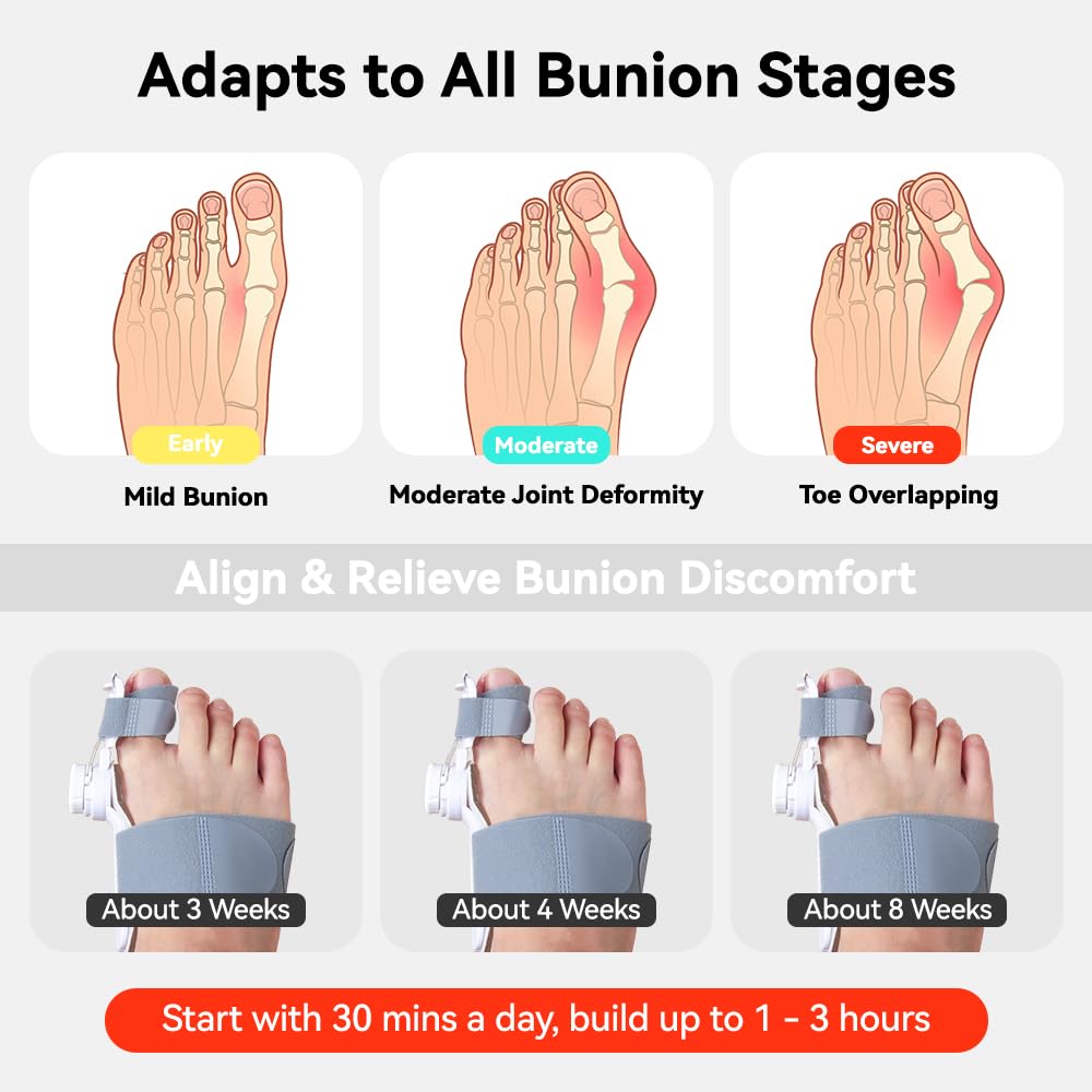 XRUIDI Bunion Corrector for Women & Men Adjustable Big Toe Splint for Hallux Valgus Relief & Toe Alignment, Orthopedic Brace for Pain Relief & Toe Alignment Fits Left & Right Feet 1 PACK