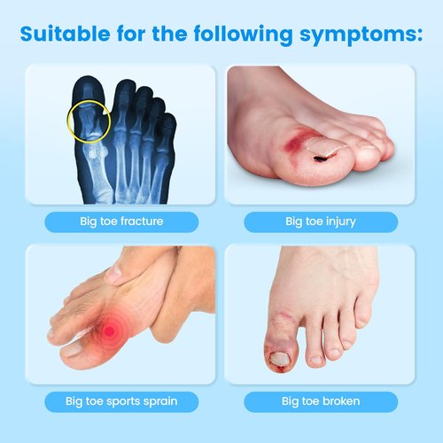 Broken Big Toe Splint Brace, Fracture Big Toe Protector for Dislocations, Injuries, Sprains, Support with 2 Stainless Steel Plate - Right