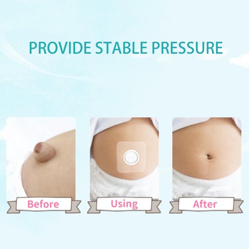 ENLUNTRA Belly Button Shaper with Waterproof Cotton Pads(5 Pieces),Baby Belly Band,Baby Belly Button Band,Baby Belly Button wrap 8×8cm