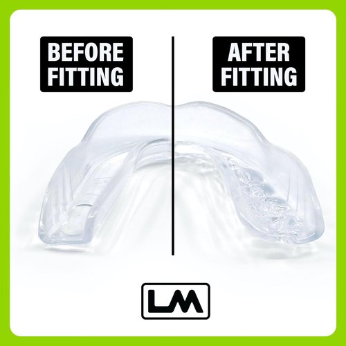 Loudmouth Sport Mouth Guard - Slim-Fit Boil & Bite Design with Case | Advanced Protection for Contact Sports (Clear)