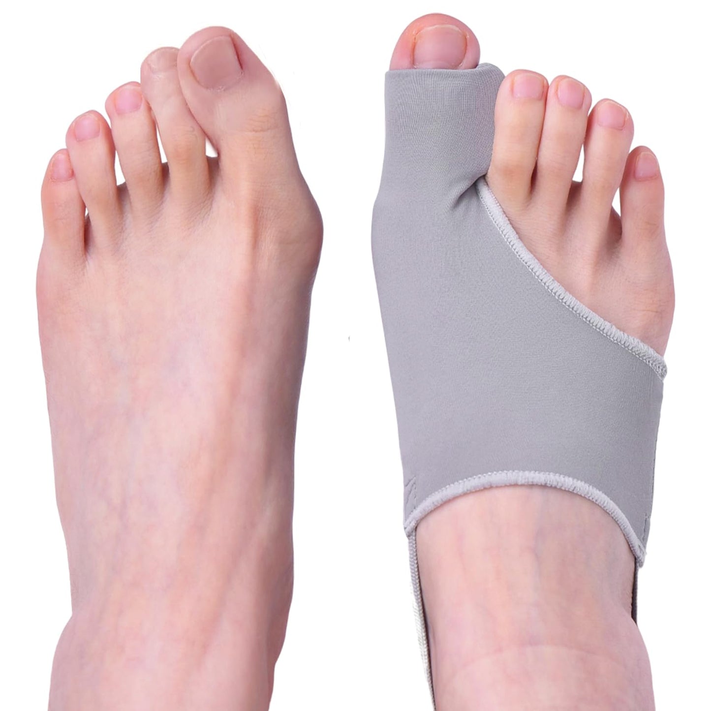 HHBOXIU Hallux valgus correction device, toe correction device. Suitable for both men and women for the correction of hallux valgus. Hallux valgus splint (gray)