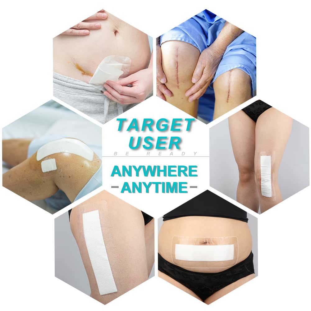 14 Pcs Waterproof Shower Protector Bandage 4"x10" for Post Knee Replacement Hip Surgery Recovery Long Surgical Incision Adhesive Larger Wounds Cover Island Dressing Bordered Gauze