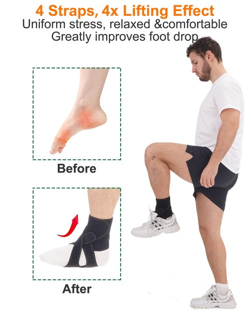 Furlove AFO Foot Drop Brace for Walking, Drop Foot Brace Soft Night Splint for for Sleeping, Adjustable Foot Support (Left)