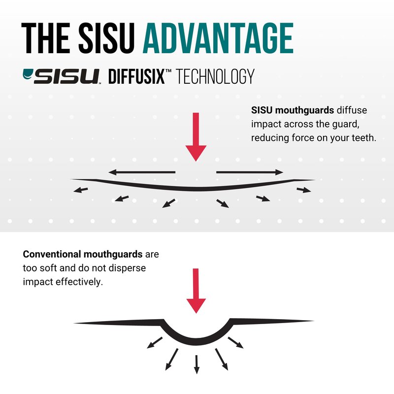 SISU Aero Small Mouthguard, Royal Blue - 30% Stronger Protection for Lacrosse, Football, Hockey, Roller Derby, Team Sports - Remoldable Up to 20 Times - Ultra Slim - Non Toxic