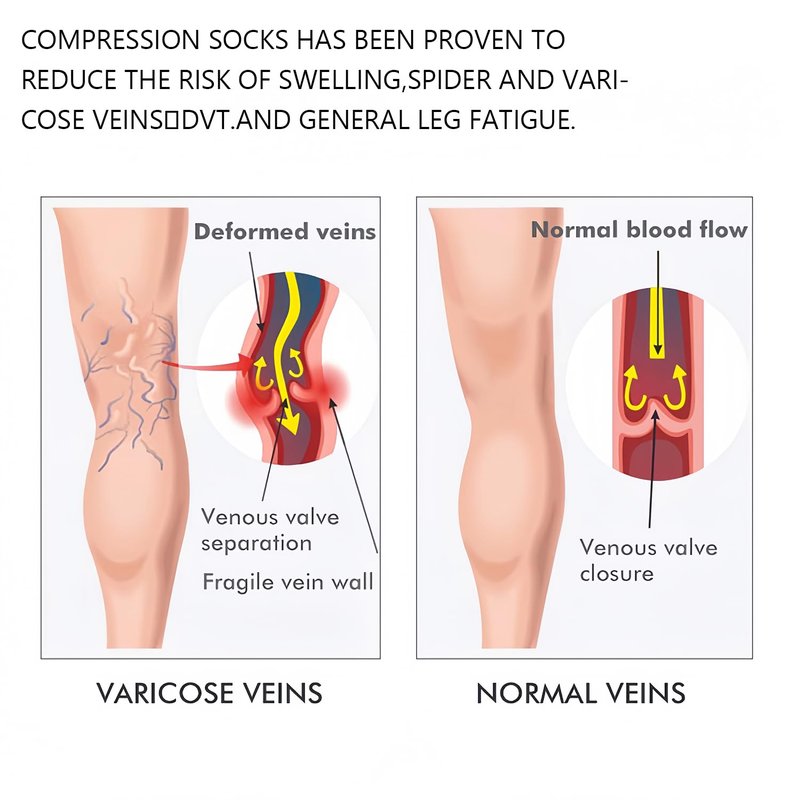 15- 20 mmhg Compression Stockings for Women & Men , Knee High Graduated Open Toe Compression Socks for Varicose Veins, Swelling, Edema, Travel & Flight