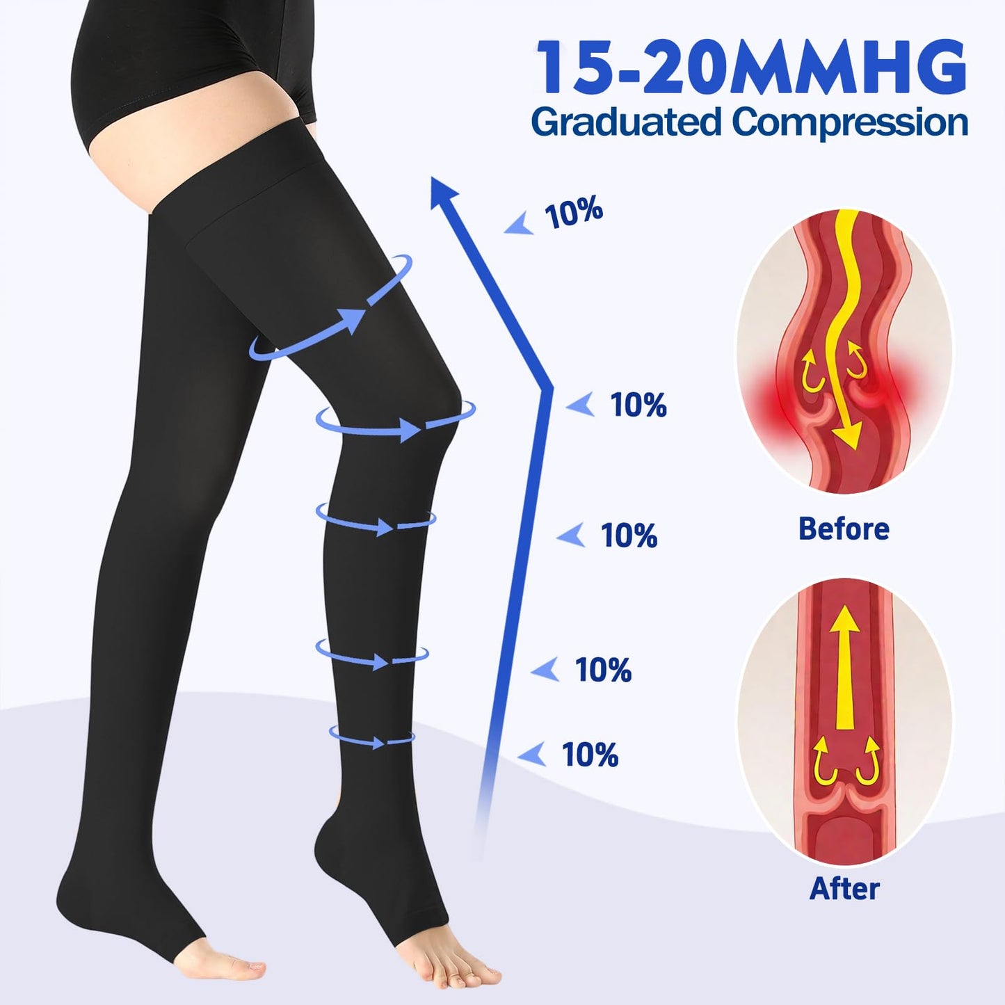 BURLWAY Open Toe Thigh High Medical Compression Stockings For Women & Men,15-20 mmHg Thigh High Compression Socks,Firm Graduated Support Hose with Silicone Dot Band-Ideal for Varicose Veins(1 Pair)